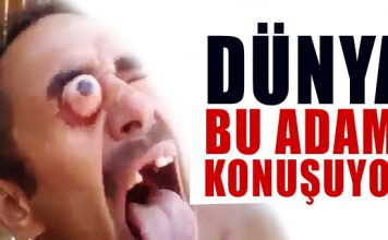 Gözleri yerinden fırlayan adam, görenleri korkuttu