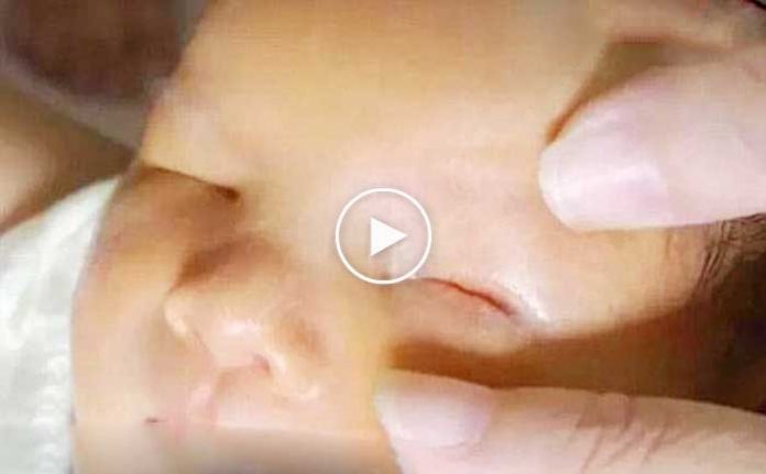 gozu-olmayan-bebek-dogdu-video-izle-ilginc-hastaliklar