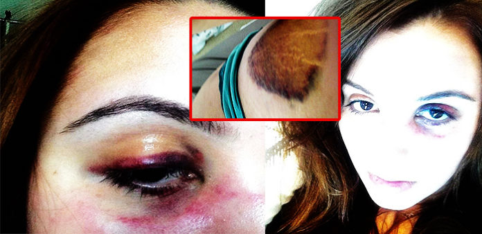 Öğrencisi-olan-sevgilisinin-gözüne-tuz-döküp-dövdü-son-dakika-oku