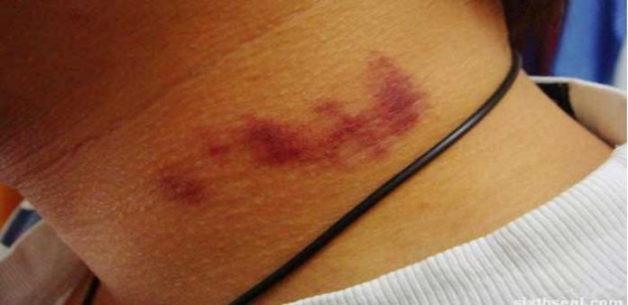 Sevgilisini-boynundan-ısırınca-öldü-izle-haeri