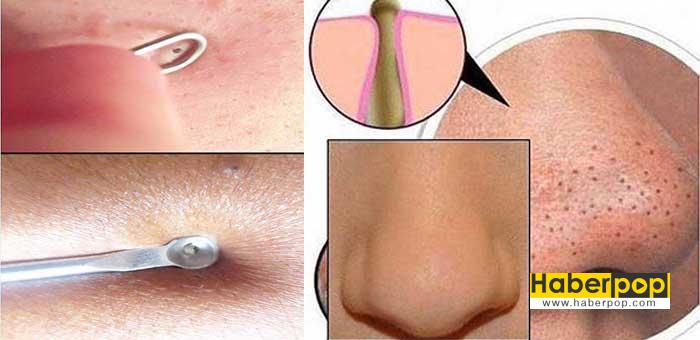 siyah nokta vucudumuzdaki leke temizleme maskesi haberpop