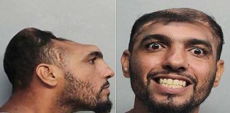 Yarım beyinli adam ev yakmaktan tutuklandı