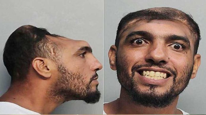 yarim-beyinli-adam-ev-yakmaktan-tutuklandi-izle-video