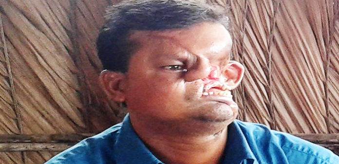 Yüzünü-kaplan-parçaladı-Yüzünü-herkesten-sakladı-izle-video-haber