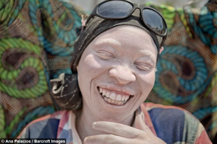 albino-siyahlar-02-haberpop