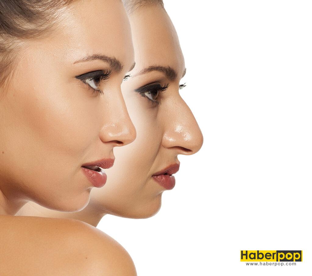 Comparison of female nose before and after cosmetic surgery