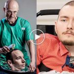 Dünyanın ilk kafa nakli yapılıyor