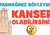Kanser Belirtileri! Vücutta Oluşan Kanser Belirtileri parmaginizin boyu boyleyse kanser olabilirsiniz-yuz sekliniz ve parmak boylari ve anlamlari ne demek-hangi hastalik demek-haberpop