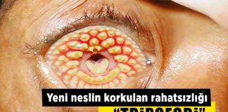 27 fotoğrafta yeni çağın korkulu rüyası delik fobisi: Tripofobi