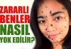 Hangi Benler Tehlikelidir? Vücuttaki ve Yüzdeki Benler Nasıl Geçer?